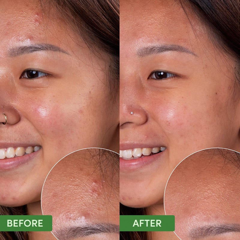 Sand & Sky Oil Control Gentle Face Cleanser with AHA & BHA - pH-Balanced Blemish Cleanser, Reduces Redness, For Oily Skin & Breakouts, 4.2 fl oz - Image 4