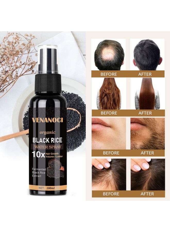 Venanoci - Hair Growth Serum, Rice Water Spray For Women & Men Treatment For Hair Loss, Damaged Dry Hair, Hair Regrowth For Thicker Longer Fuller Hair With Castor Oil Ginger - Image 1