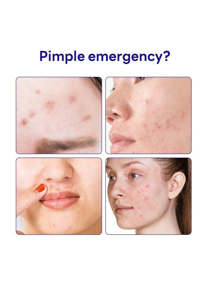 MEDIHEAL - Derma Clear Madecassoside Blemish Spot Patch (132 Counts) Acne Spot Protection Spot Fast Healing With Madecassoside & Niacinamide - Image 1