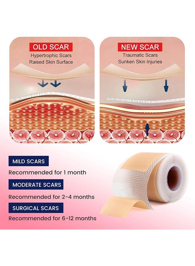 شرائح سيليكون للندبات (1.6 بوصة × 120 بوصة)، لفة شريط طبي ناعم للولادة القيصرية والجراحة والحروق والجُدْرَة وحب الشباب 4 سم × 1.5 متر - Image 5