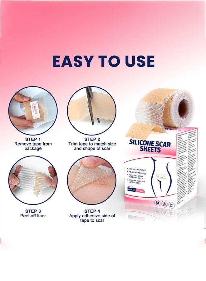 شرائح سيليكون للندبات (1.6 بوصة × 120 بوصة)، لفة شريط طبي ناعم للولادة القيصرية والجراحة والحروق والجُدْرَة وحب الشباب 4 سم × 1.5 متر - Image 4