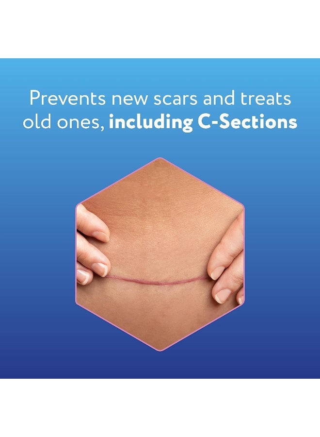 SCARAWAY C-Section Scar Treatment Silicone Adhesive Soft Fabric 4-Sheets Strips (7x1.5in) - Image 3