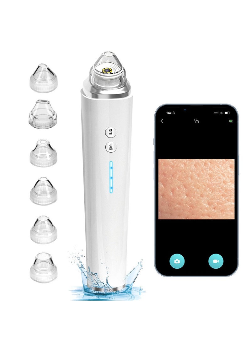 General - Blackhead Remover Tool, Pore Vacuum with 1080p HD Camera, Facial Pore Cleanser, Pimple Acne Extractor Kit Suction Tool with 6 Suction Heads - Image 1