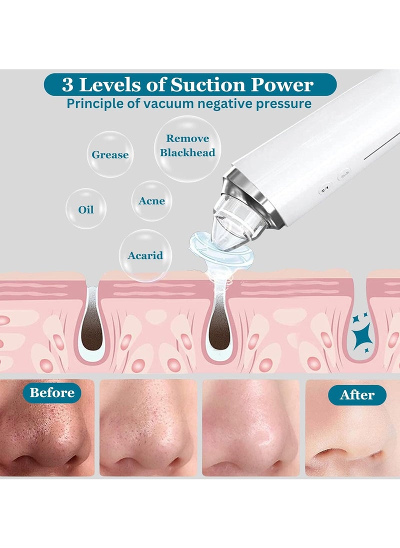 General - Blackhead Remover Tool, Pore Vacuum with 1080p HD Camera, Facial Pore Cleanser, Pimple Acne Extractor Kit Suction Tool with 6 Suction Heads - Image 1