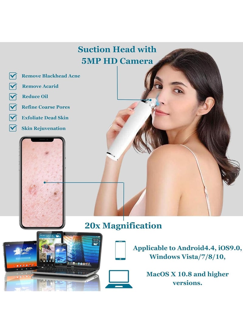 General - Blackhead Remover Tool, Pore Vacuum with 1080p HD Camera, Facial Pore Cleanser, Pimple Acne Extractor Kit Suction Tool with 6 Suction Heads - Image 1