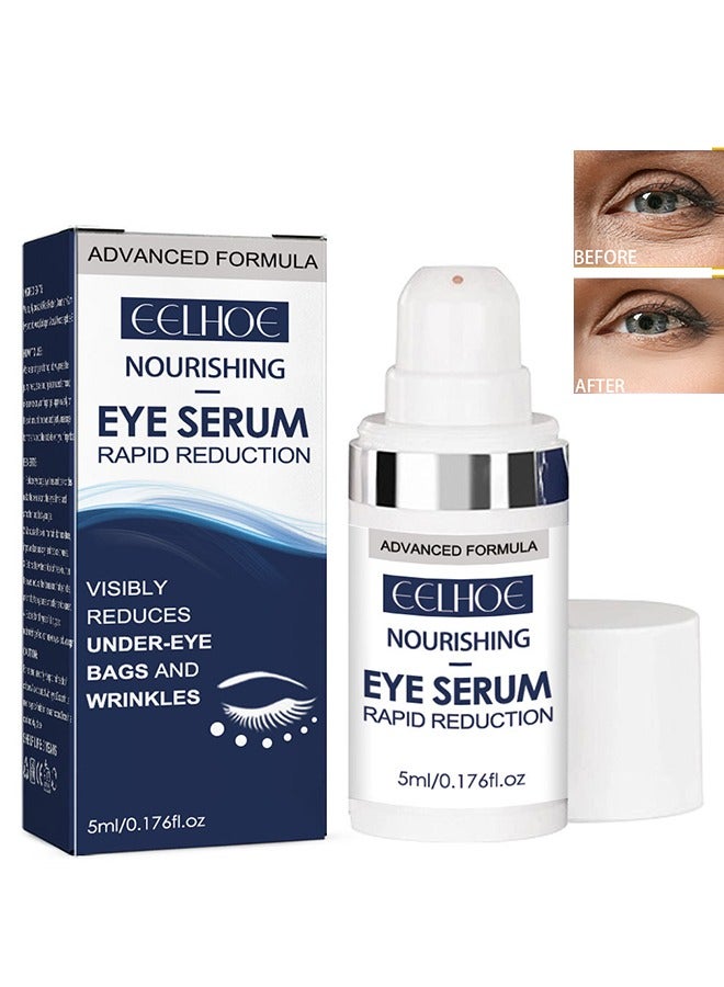 إيلهو مصل العيون المغذي للحد السريع ، مصل العين للحد السريع - مصل مضاد للشيخوخة يقلل بشكل واضح من الانتفاخات تحت العين والتجاعيد والهالات السوداء والخطوط الدقيقة وأقدام الغراب على الفور 5 مل - Image 1