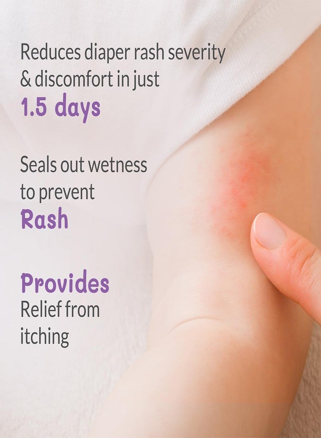 AreoVeda Diaper Rash Cream (50 gm), Suitable for newborns & babies, 15% Zinc Oxide, Prevents & Soothes Rashes from Day 1, Relieves Itchiness & Discomfort - Image 3