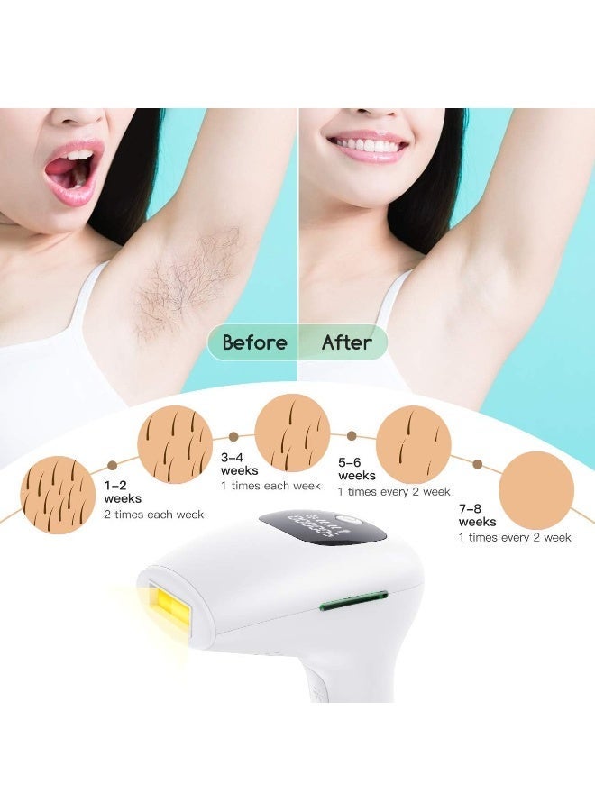 جهاز إزالة الشعر بالليزر IPL، 5 مستويات، 500,000 ومضة، جهاز إزالة الشعر الدائم، جهاز إزالة الشعر غير المؤلم، أبيض - Image 5