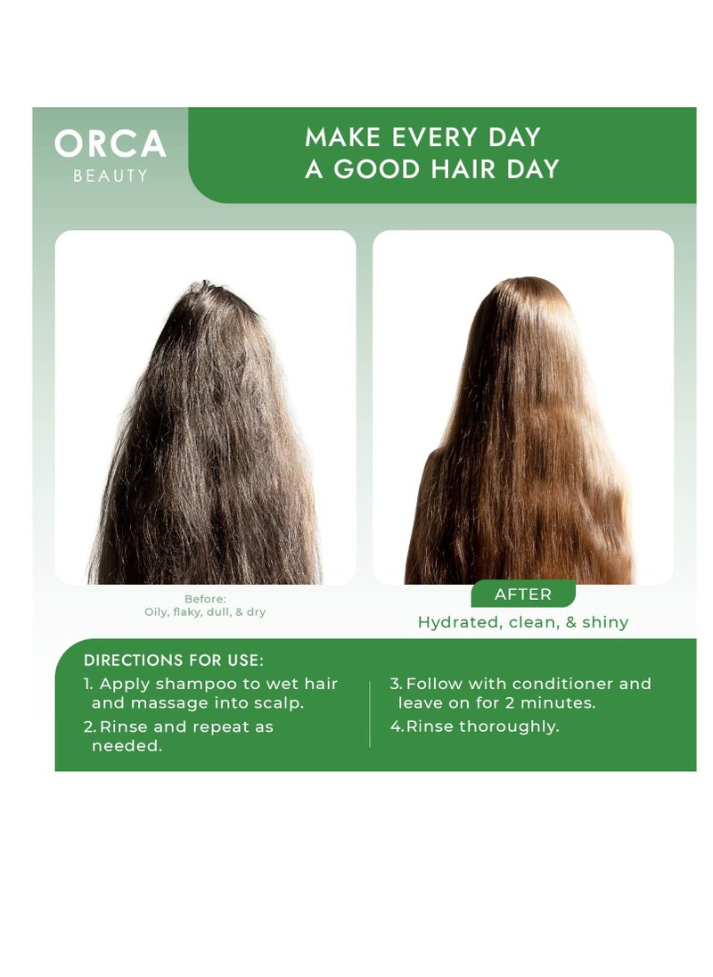 Orca Beauty - Tea Tree Conditioner, 16oz - Hydrating and Invigorating Natural Conditioner for Men & Women with Oily Hair and Dry Scalp, Enriched with Vitamin E, Coconut Oil, Silk Proteins, and Rosemary - Image 1