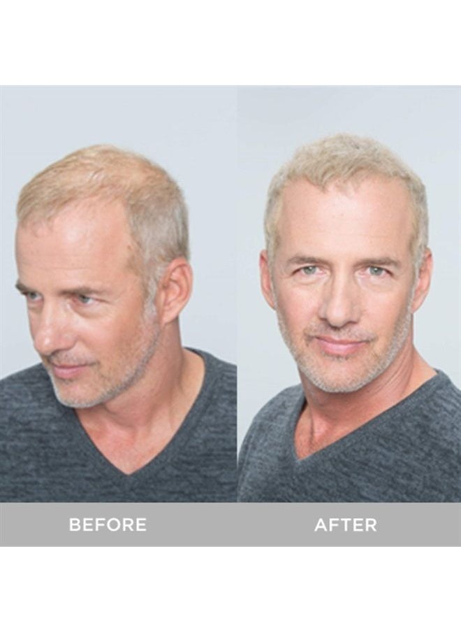 Xfusion Keratin Hair Fibers - White (15g)  - Image 4