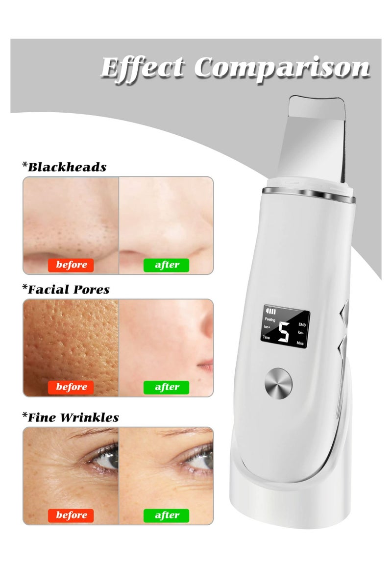 CMGTYYD Skin Scrubber, Blackhead Remover Tool with Rechargeable Base, LCD Display, Ultrasonic Skin Scraper Pore Cleanser Skin Care Tools for Facial Deep Cleansing - 4 Modes - Image 5