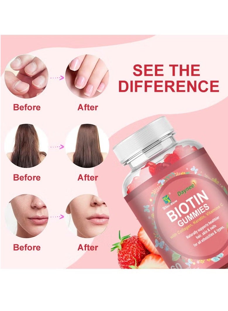 Biotin Gummies With Collagen Vitamins, Gluten Free Vegan Skin And Nails Care Supplements Vitamins, Non GMO Vitamin B And C Chewable Gummies For Healthy Hair, Skin, And Nails