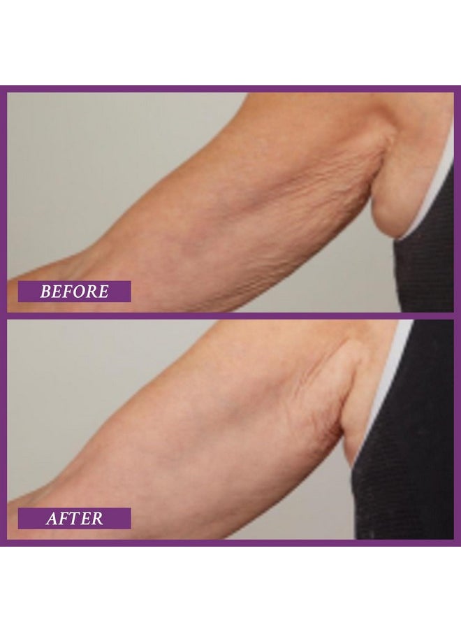Prai Beauty Ageless Upper Arm Creme Antiaging And Repairing Body Cream Skin Firming And Tightening Lotion For Upper Arm Firming Lotion For Loose Skin 6.7 Oz  - Image 2