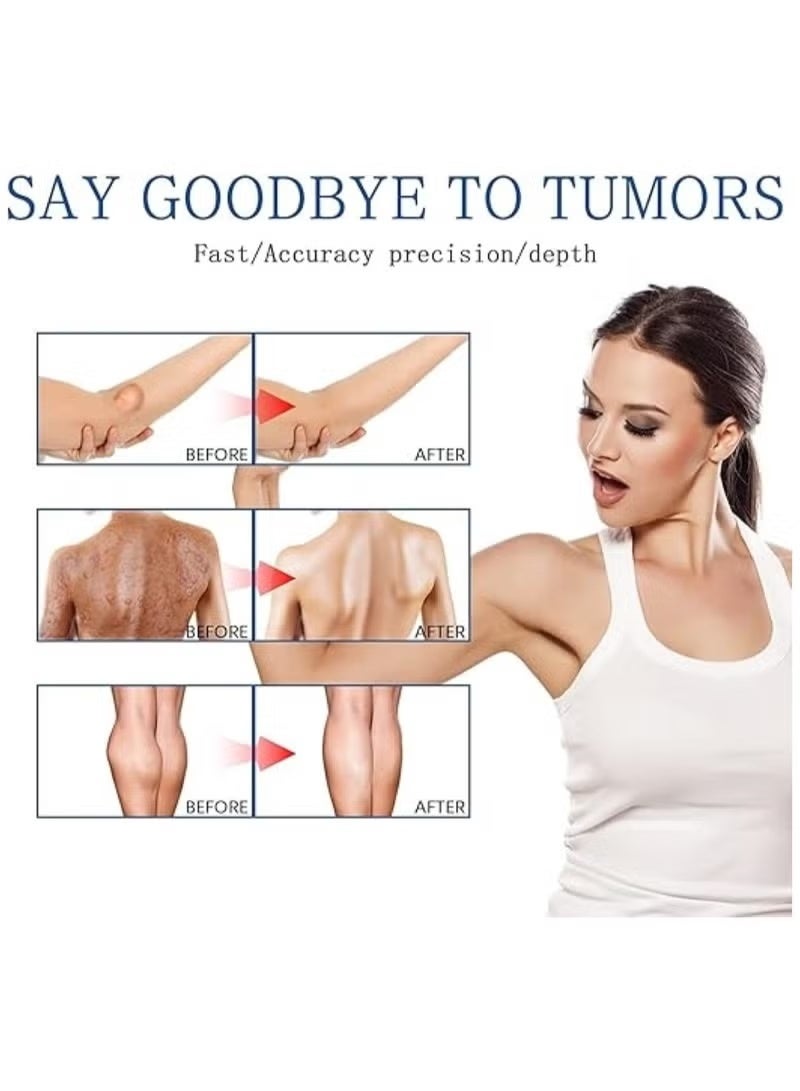 SOUTH MOON Southmoon Lumpfree Lipoma Removal Spray, , Lipomheilung Reduction Spray, Instant Lipoma Removal Spray, Skin Tightening Spray 50ml. - Image 3