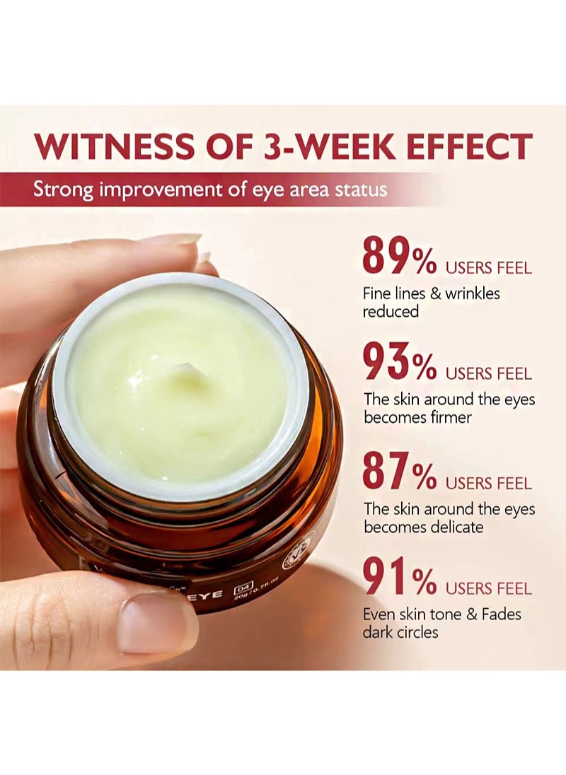 Retinol Eye Cream， Anti-Aging Firming Anti-Puffiness，Improve Dark Circles And Reduce Fine Lines Around The Eyes, Including Eye Massage Stick (20g)