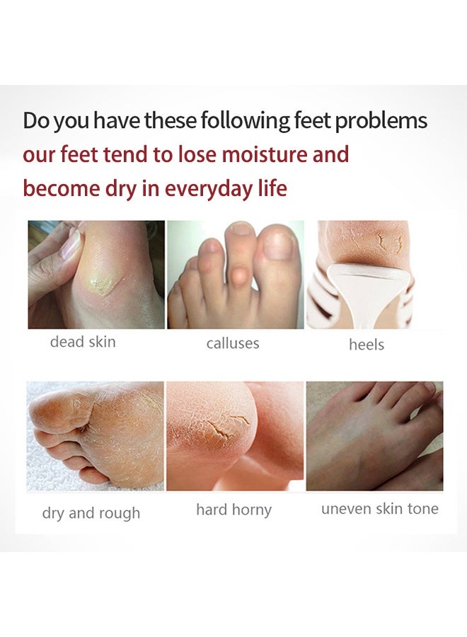 efero Foot Mask-Rose Exfoliating Foot Mask, Baby Soft Foot Mask Socks for Removing Dead Skin, Cracked Heels, and Calluses (Rose) - Image 3