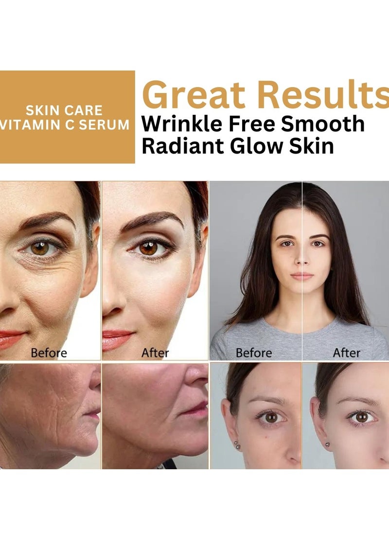 COAZON - Vitamin C Serum Brightening Skin Corrector for Face with Vitamin E and Hyaluronic Acid Boost Skin Collagen Hydrate and Plump Skin Anti Aging and Wrinkle Facial Serum 30ml - Image 1