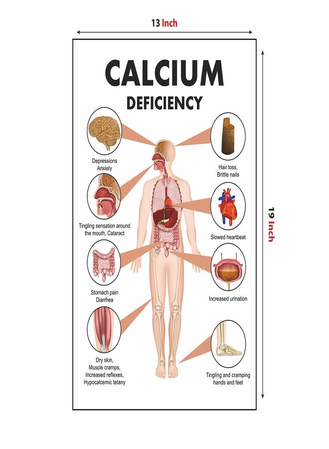 Anne Print Solutions Calcium Deficiency Poster for Hospital, Nursing Home, Clinic (Size 13X19 Inch, Printed on Non-Tearable Imported Sheet) - Image 2