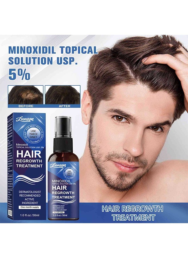 LUNOON - Minoxidil Hair Regrowth Treatment - Growth Spray For Men and Women , 5% Minoxidil Hair Serum For Stronger Thicker Longer Hair Help to Stop Thinning and Loss Hair 30ml - Image 1