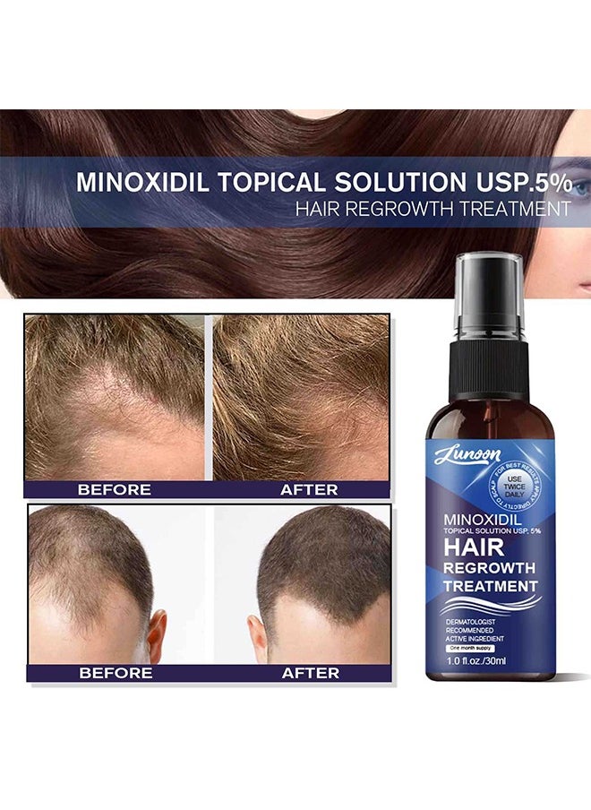 LUNOON - Minoxidil Hair Regrowth Treatment - Growth Spray For Men and Women , 5% Minoxidil Hair Serum For Stronger Thicker Longer Hair Help to Stop Thinning and Loss Hair 30ml - Image 1