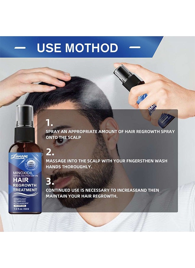 LUNOON - Minoxidil Hair Regrowth Treatment - Growth Spray For Men and Women , 5% Minoxidil Hair Serum For Stronger Thicker Longer Hair Help to Stop Thinning and Loss Hair 30ml - Image 1