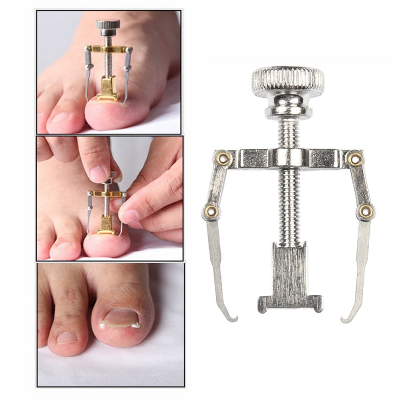 Ingrown Nail Correction Toenail Lifter Stainless Steel - Effective Treatment Toenail Clamp Breathable Design for Pain Relief - Image 4