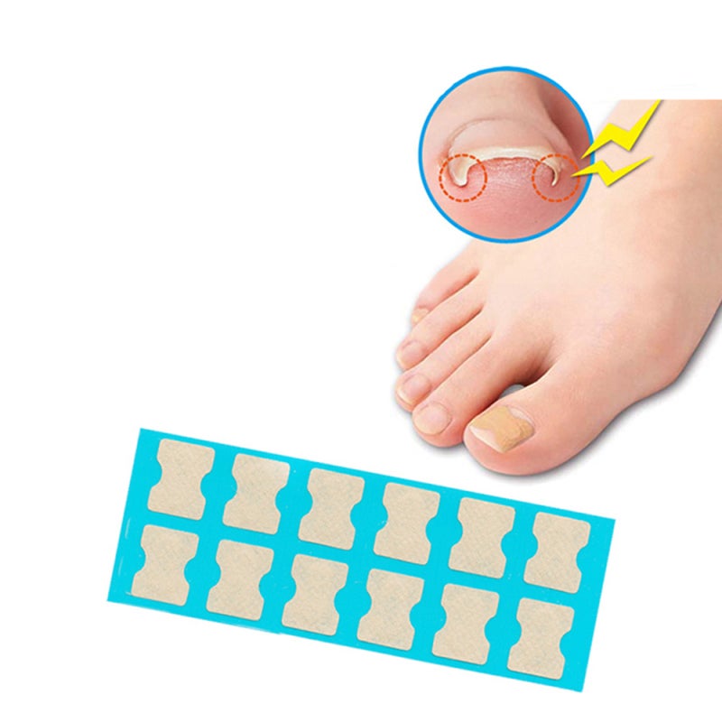 Ingrown Nail Correction Toenail Lifter Stainless Steel - Effective Treatment Toenail Clamp Breathable Design for Pain Relief - Image 3