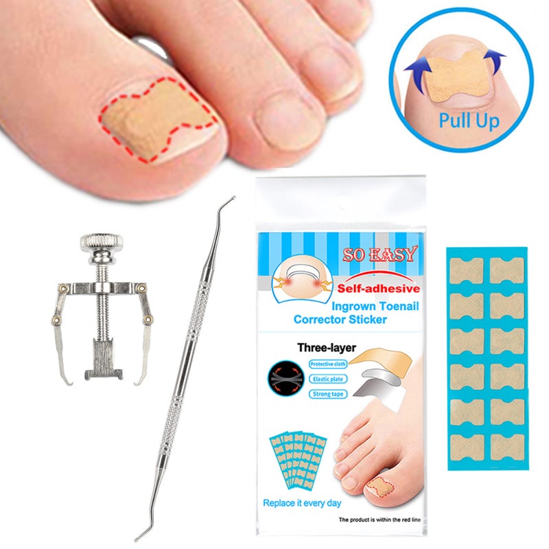 Ingrown Nail Correction Toenail Lifter Stainless Steel - Effective Treatment Toenail Clamp Breathable Design for Pain Relief - Image 2