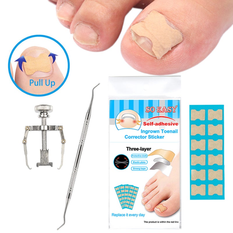 Ingrown Nail Correction Toenail Lifter Stainless Steel - Effective Treatment Toenail Clamp Breathable Design for Pain Relief - Image 1