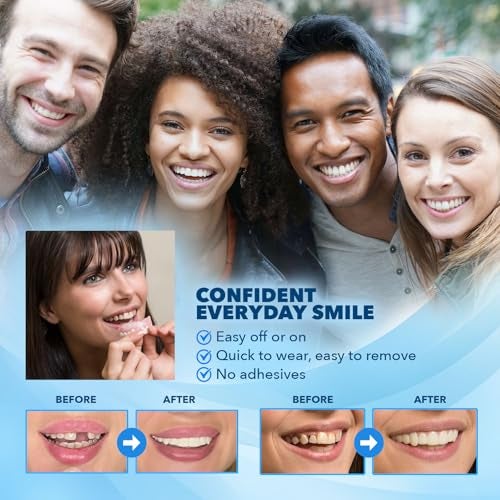 Imako Premium Cosmetic Uppers 1 Pack Small Bleached White DIY Smile Makeover Made in USA - Image 3