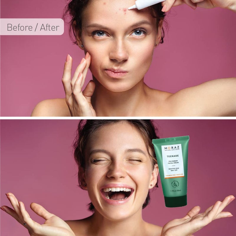 Moraz Polygonum Face Cream, Helps Reduce Teenage Oily Skin Problems, Facial Cream, Face Moisturizer, Common Teenager Oily Skin Treatment, 1.7 FL.OZ (50ml) - Image 5