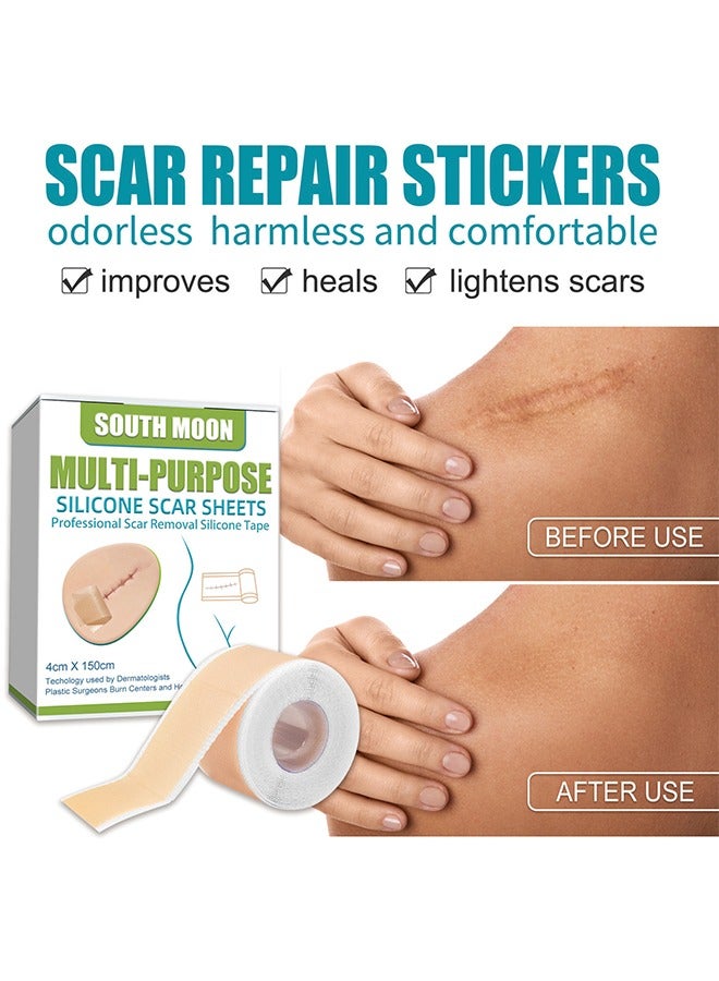 SOUTH MOON Silicone Scar Sheets, Fade Scars Efficient Cosmetic Scar Removal For Cesarean Section Burn Scars And Other Scars Left Behind Gel Painless Tape Roll (4cm X 1.5m) - Image 3