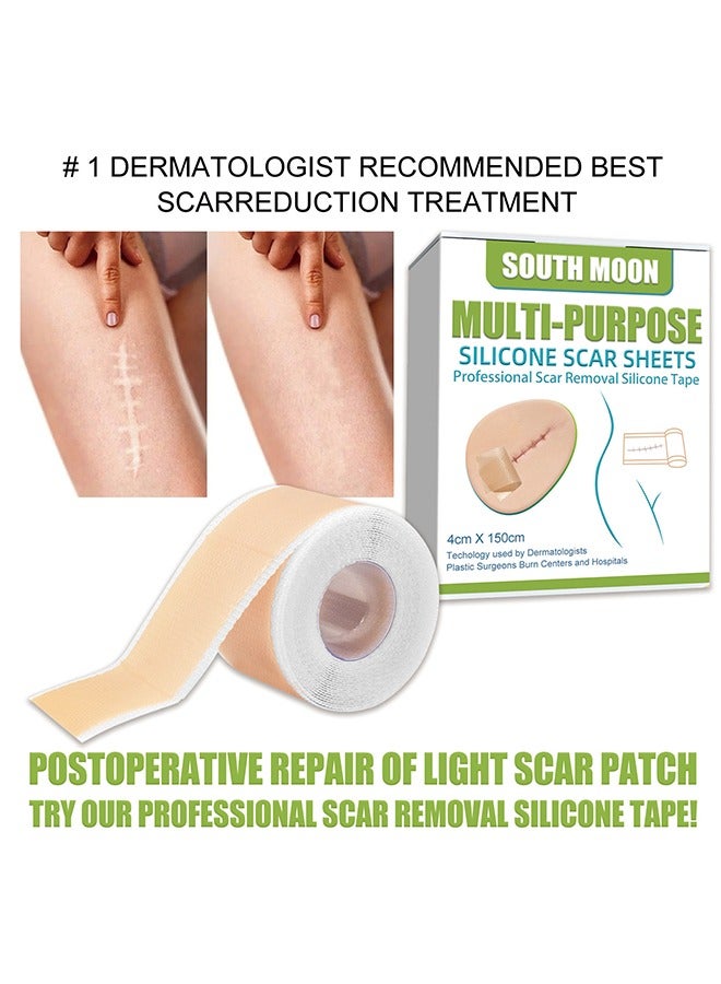 SOUTH MOON Silicone Scar Sheets, Fade Scars Efficient Cosmetic Scar Removal For Cesarean Section Burn Scars And Other Scars Left Behind Gel Painless Tape Roll (4cm X 1.5m) - Image 4