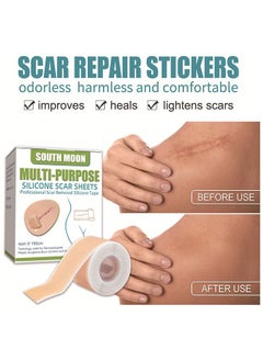 SOUTH MOON Silicone Scar Sheets, Fade Scars Efficient Cosmetic Scar Removal For Cesarean Section Burn Scars And Other Scars Left Behind Gel Painless Tape Roll (4cm X 1.5m)  - Image 3