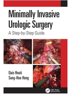 Minimally Invasive Urologic Surgery: A Step-by-Step Guide 