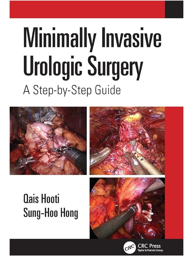 null - Minimally Invasive Urologic Surgery: A Step-by-Step Guide - Image 1