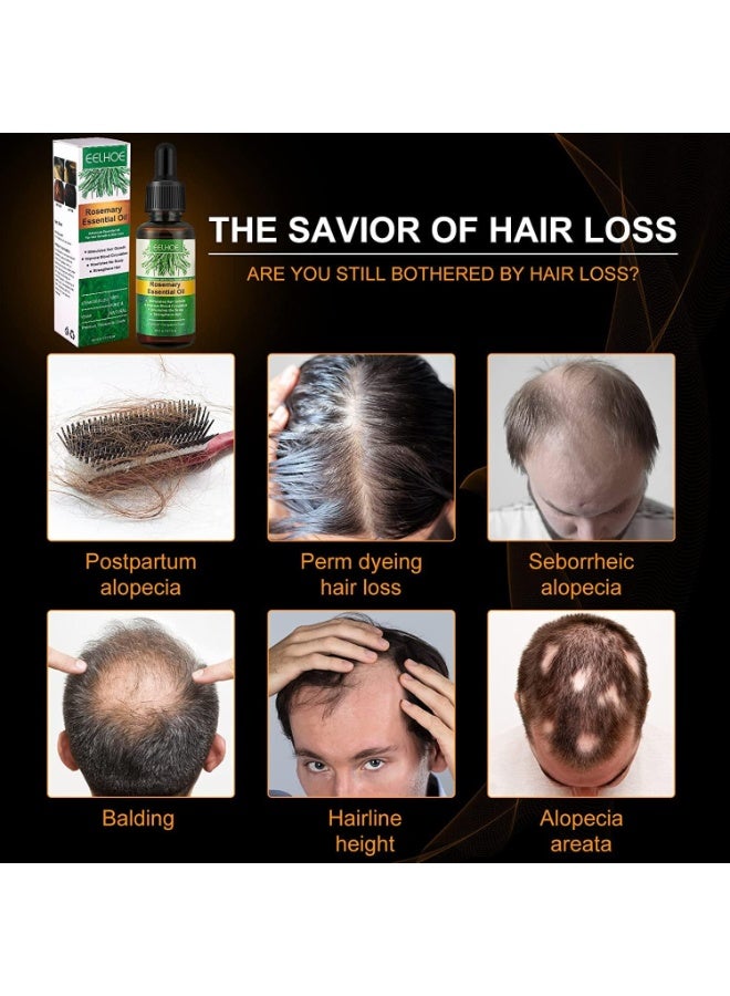 EELHOE Organic Rosemary Essential Oil for Hair Growth, Hair Loss Treatment, Scalp Nourishment, Stimulating Hair Growth, Improving Scalp Circulation, Relieving Itching, Dry Scalp Treatment for Unisex, 2 Pieces - Image 5