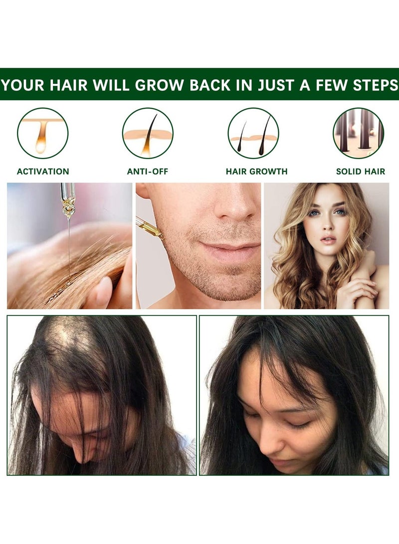 إيلهو زيت روزماري للشعر وفروة الرأس العطري الطبيعي بنسبة 100% لنمو الشعر وتعزيز نمو الصحي وتحفيز من قطعتين - Image 3