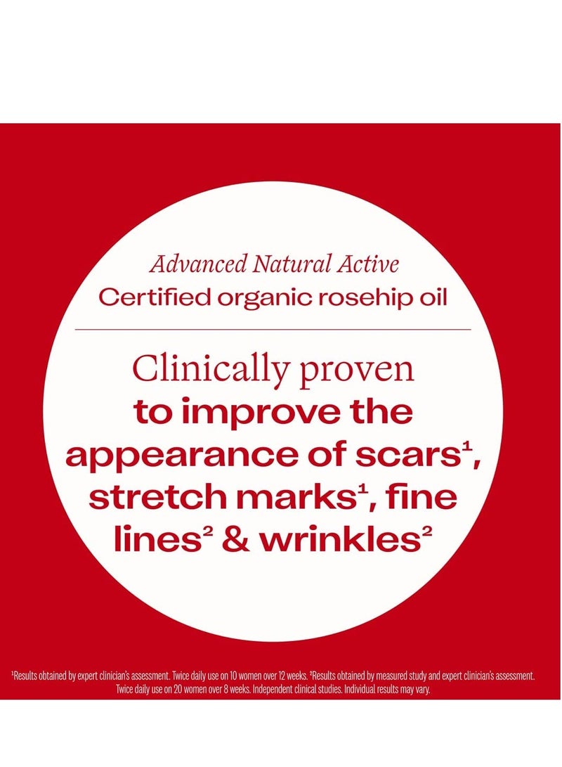 تريلوجي زيت الورد العضوي المعتمد من تريلوغي - زيت بذور الورد البكر المضغوط على البارد للندبات، علامات التمدد، الخطوط الدقيقة والتجاعيد - مع أوميغا 3 و6 و9 لجميع أنواع البشرة، معتمد من وزارة الزراعة الأمريكية، 1.52 أونصة - Image 2