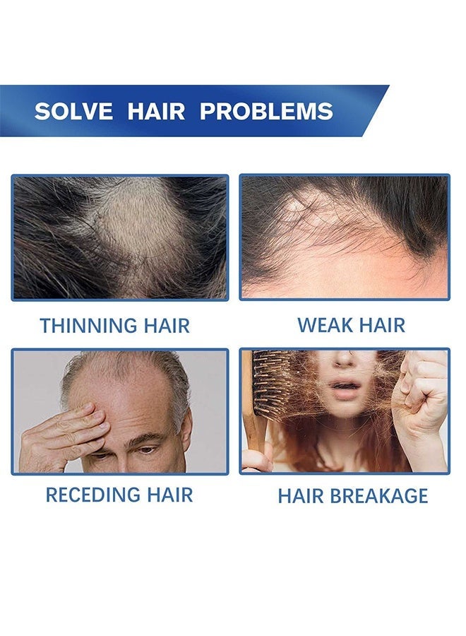 لونون علاج نمو الشعر المينوكسيديل - بخاخ نمو للرجال والنساء ، مصل شعر 5٪ مينوكسيديل لشعر أقوى وأكثر كثافة وأطول يساعد على وقف ترقق وتساقط الشعر 30 مل - Image 5