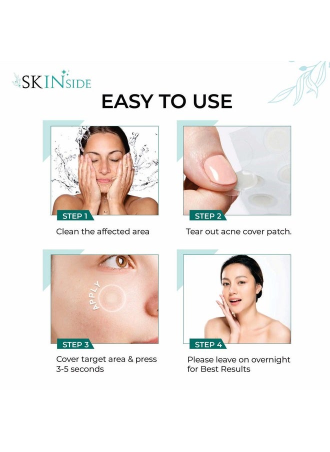 Skinside - Acne Pimple Patches For Face Pimples Hydrocolloid Facial Spot Patches With 0.5% Salicylic Acid For Pimple Healing Invisible Waterproof Absorbs Excess Oil & Pimple Overnight (36 Patches) - Image 1