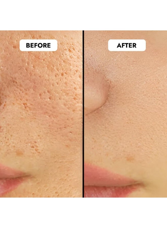 CosIQ Cos-IQ B3 5% Niacinamide Face Serum for Clear Glowing Skin, Reduces Dullness, Hydrates & Repairs Skin with Vit B3 & Hyaluronic Acid, Day & Night Serum | For Women & Men | 30ml pack of 2 - Image 3