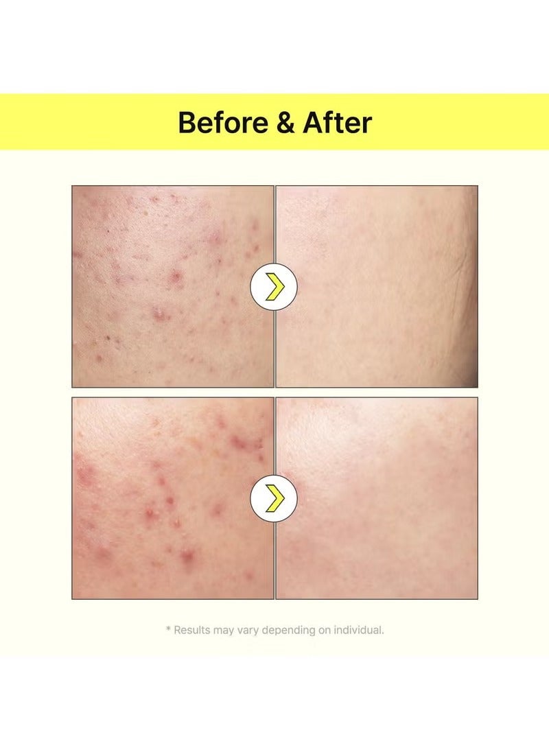 TIA'M Vita B3 Source, 1.35 fl oz, 10% Niacinamide Glow Serum with 2% Arbutin for Radiant & Balanced Skin, Vegan Korean Skin Care - Image 3