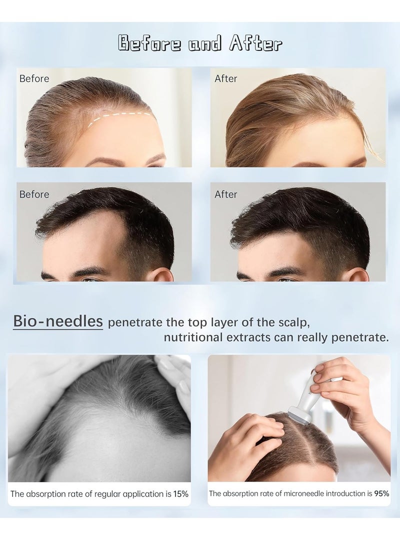 bio needle - Adjustable 0-2mm 120 Pins Derma Stamp Microneedling Pen Microneedle Stamp For Hair, Beard Growth, Shrink Pores, Brighten Skin Tone - Image 1