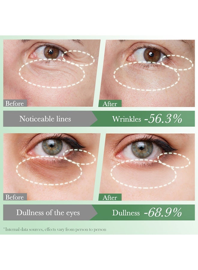 FAYANKOU Snowgrass Anti-Wrinkle Moisturizing Eye Cream FAYANKOU Hydrating Moisturizing Eye Cream - Image 5