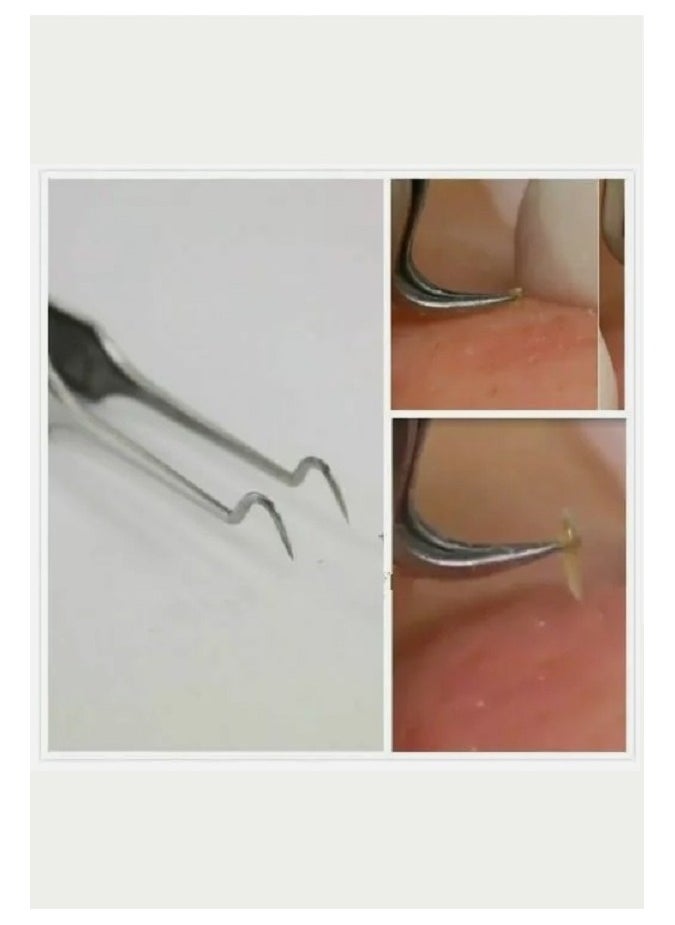 Oriflame Advanced Blackhead Remover Tweezers  - Image 3