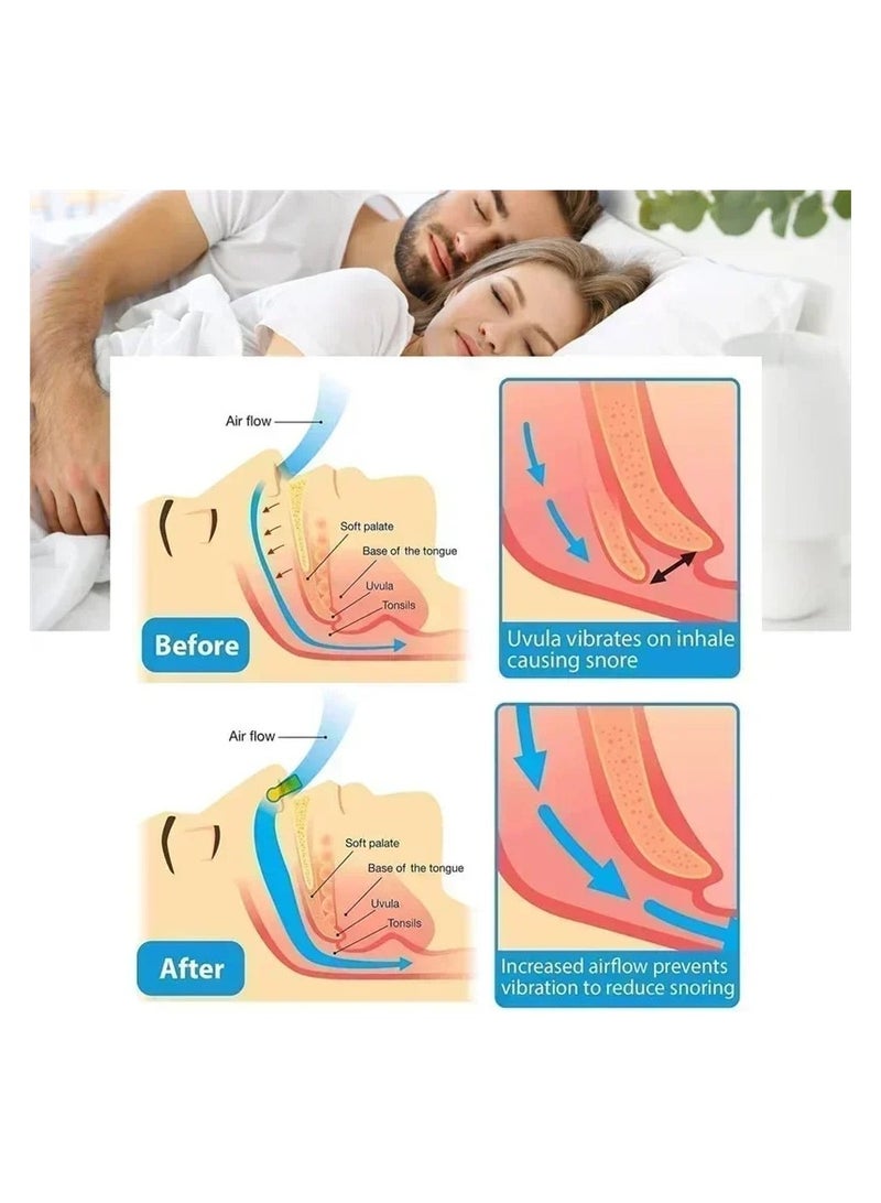 Nose Clip Silicone Anti Snoring Aid Snore Stopper without box - Image 3