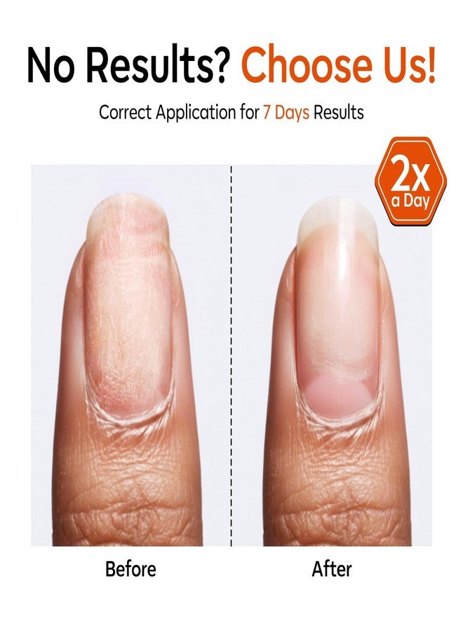 modelones Nail Strengthener and Growth Scented Nail Repair for Damaged Nails Hardener Extra Strong and Growth 3-in-1 Repair Mode Gifts for Women 13.5ml 0.46 Fl Oz - Image 5