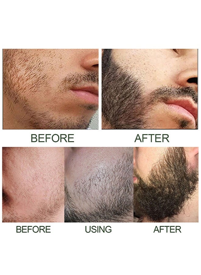East Moon - Beard Growth Serum - Men's Beard Thickening Care Set, Serum and Roller for Better Results 60ml - Image 1