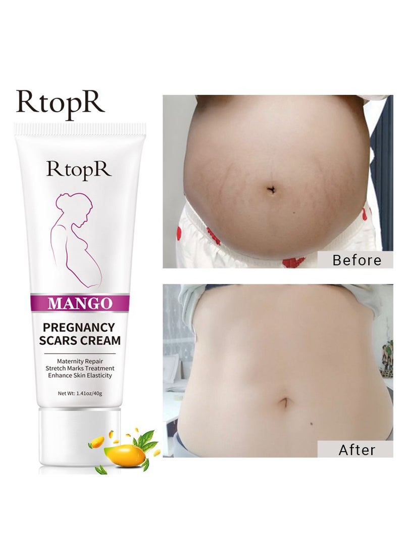 RtopR Mango Pregnancy Scars Cream Maternity Repair Enhance Skin Elasticity Stretch Marks Treatment for Wrinkles Obesity Stretch Mark Moisturizing Remove Marks 40g - Image 4
